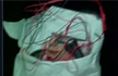 Low intensity blast in Patna, two live bombs recovered